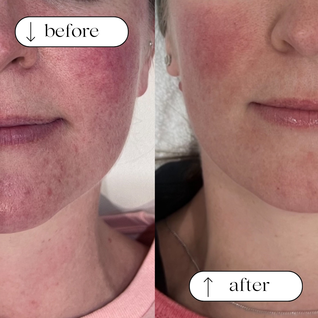 Before and after client result 2