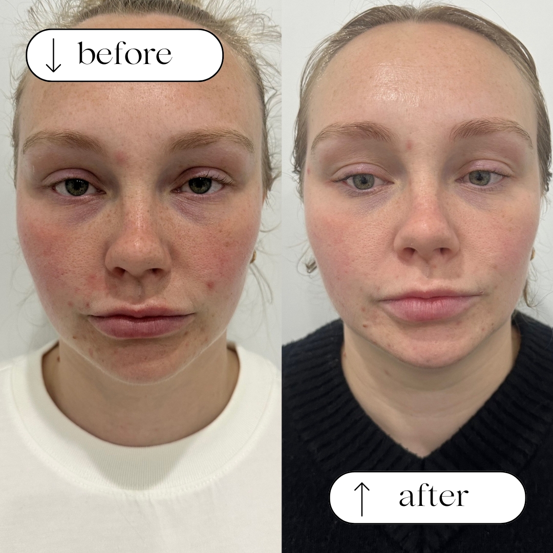 Before and after client result 4
