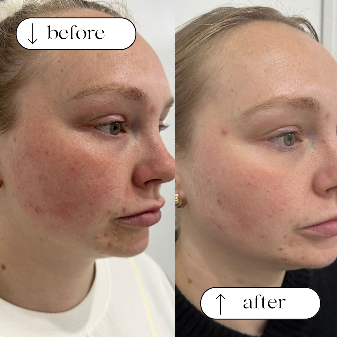 Before and after client result 3